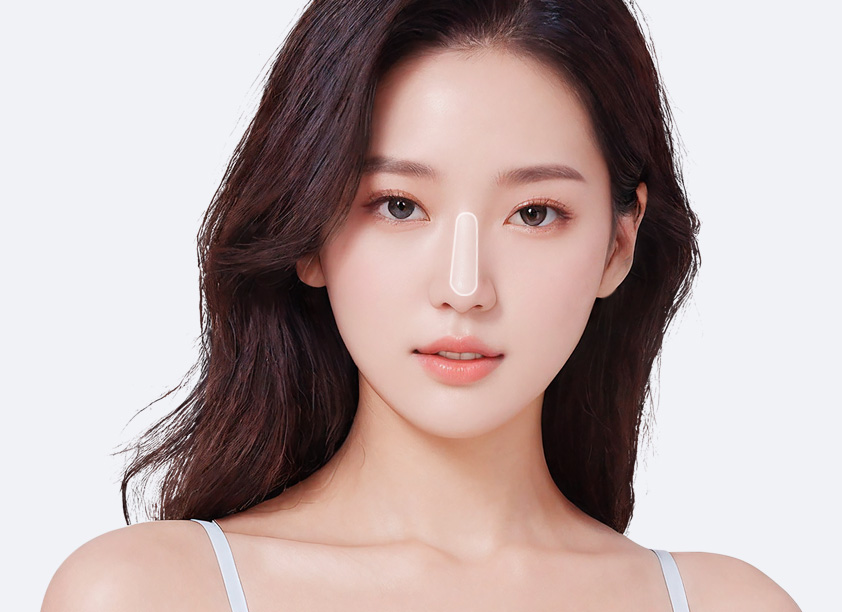 매선요법 코 시술 범위